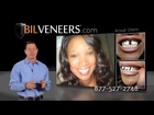 World's Best SnapOn Smile Alternative | BIL Veneers are the #1 Lab Direct Veneers